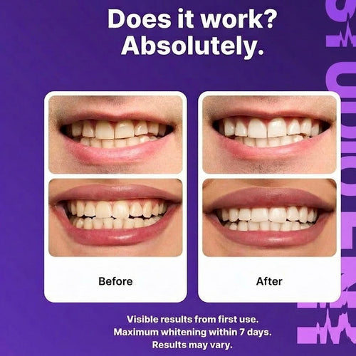 STUDIO DENT Purple Teeth Whitening Strips